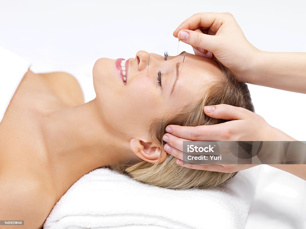 Akupunktur-Therapie in einem schönen jungen Frau - Lizenzfrei Glücklichsein Stock-Foto