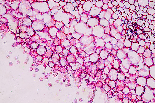 Host cells with spores (mold) are inside wood under the microscope for education.
