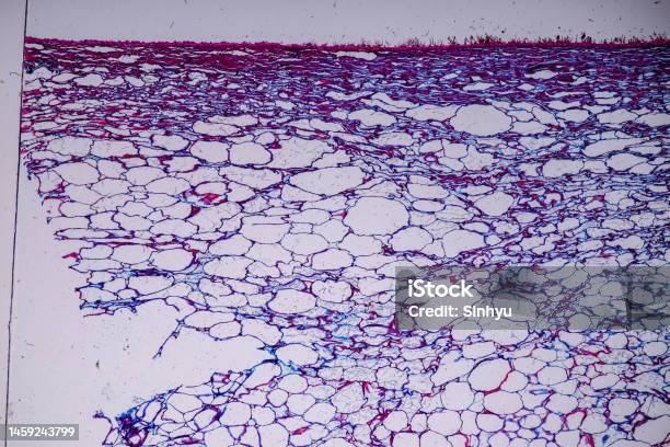 Host Cells With Spores Are Inside Wood Under The Microscope Stock Photo - Download Image Now