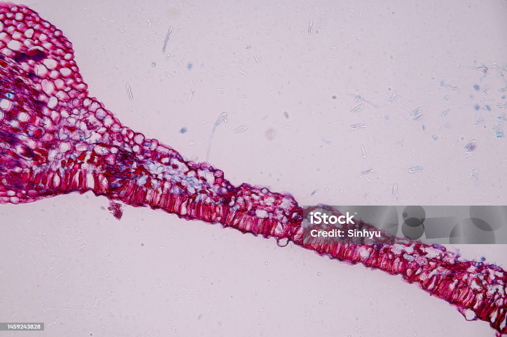 Host cells with spores (mold) are inside wood under the microscope. Host cells with spores (mold) are inside wood under the microscope for education. Backgrounds Stock Photo