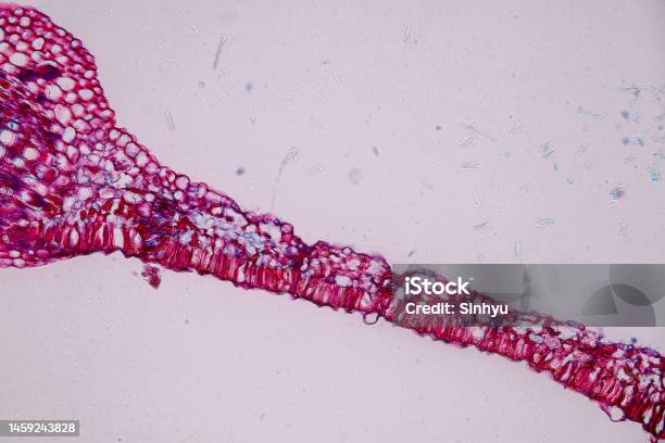 Host Cells With Spores Are Inside Wood Under The Microscope Stock Photo - Download Image Now