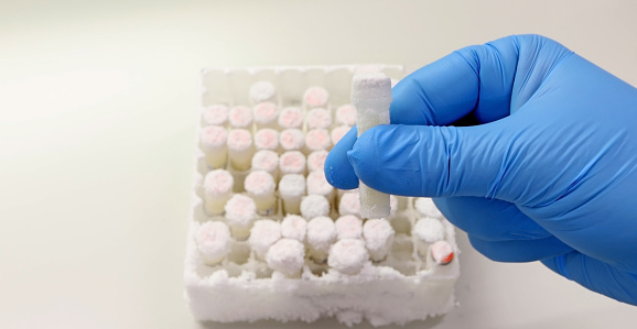 Scientist's hand with blue gloves taking frozen clinical samples