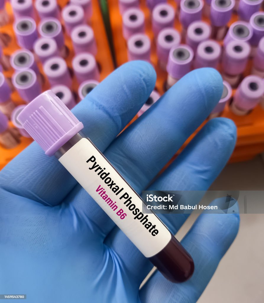 Test Tube With Blood Sample For Vitamin B6 Test For Vitamin B6 Test Tube With Blood Sample For Vitamin B6 Test For Vitamin B6