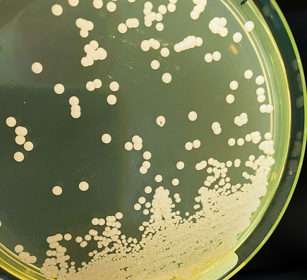 Bacteria and germs on vegetables and the health risk of ingesting contaminated green food including romaine lettuce as a produce safety concept 3D render elements.