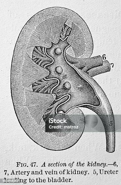 Antico Illustrazione Medica Renale - Immagini vettoriali stock e altre immagini di Vecchio stile - Vecchio stile, Trapianto di rene, Anatomia umana