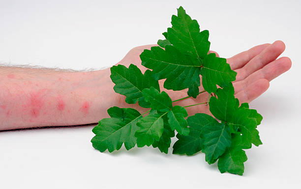 Poison Oak with Skin Rash Poison Oak leaves held by someone with a Poison Oak skin rash. posion ivy stock pictures, royalty-free photos & images