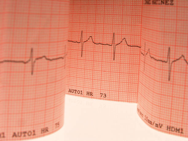 istock Electrocardiogram printout detail over a white table 1460029300