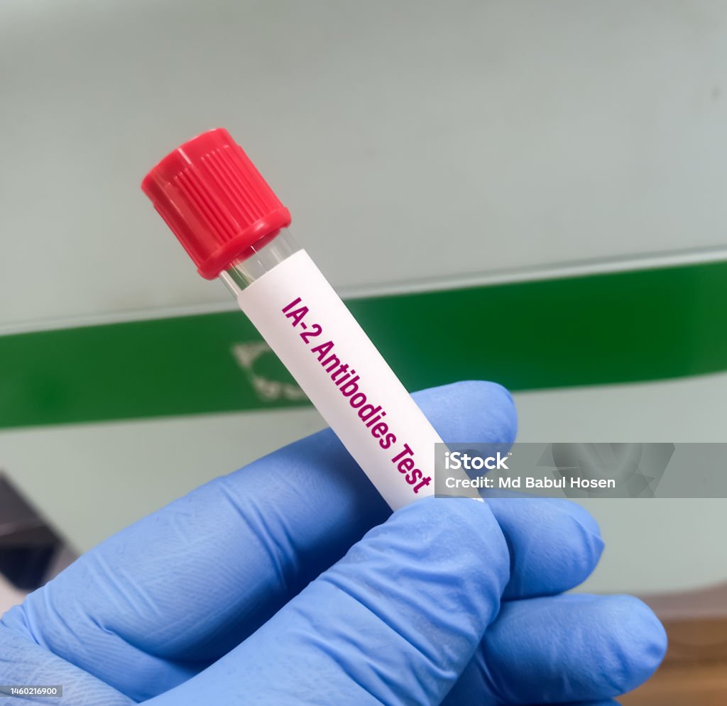Blood Sample For Islet Antigen2 Test To Determine Autoimmune Diabetes Blood Sample For Islet Antigen2 Test To Determine Autoimmune Diabetes
