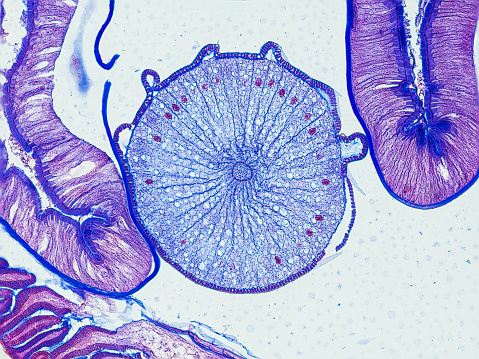 ascaris megalocephala cross section under the microscope showing an ovary - optical microscope x200 magnification