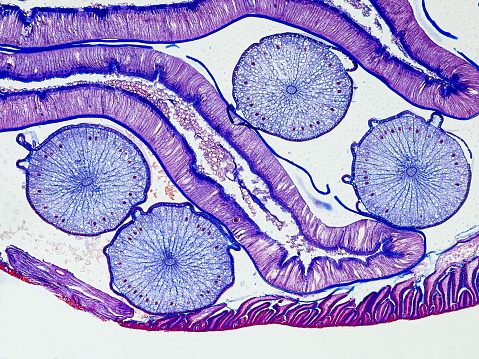 Sección transversal de Ascaris megalocephala bajo el microscopio que muestra - Microscopio óptico Aumento X100 photo