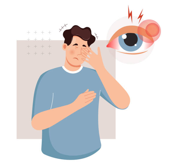 ilustrações, clipart, desenhos animados e ícones de pessoa com infecção fúngica no olho irritante - pink eye - ilustração - dry