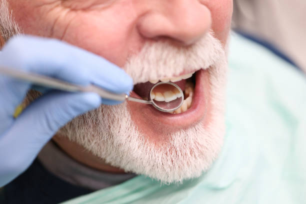 Senior man at a dentist's office