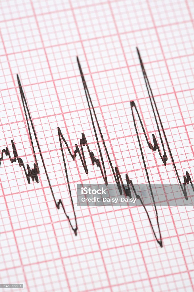 Impresión de cardiograph - Foto de stock de Asistencia sanitaria y medicina libre de derechos