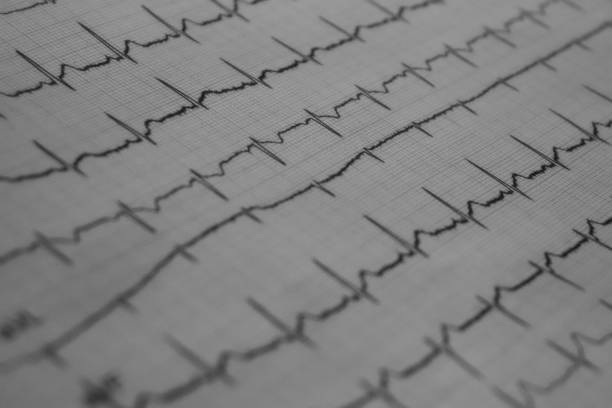 EKG from a physician EKG von einem Arzt