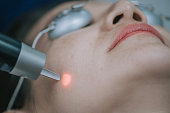 Asian Chinese male Aesthetician laser IPL treatment on his female patient in clinic