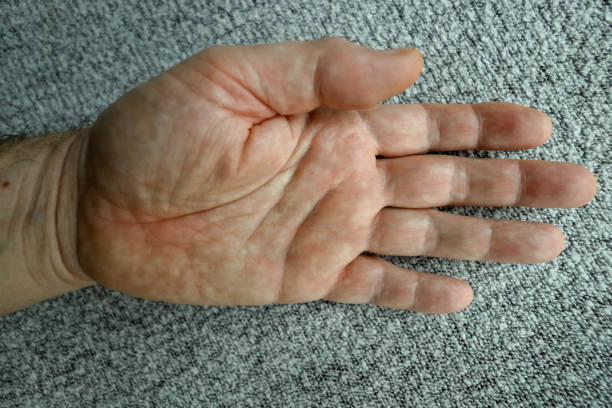 istock Human body, hand, fingers, white, old person 1461101964