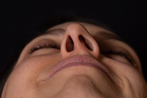 Details of a woman's nose seen from below. Obvious deviated nasal septum. Corrective surgery concept