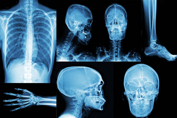 collage di raggi x parti del corpo del paziente - macchina per radiografie foto e immagini stock