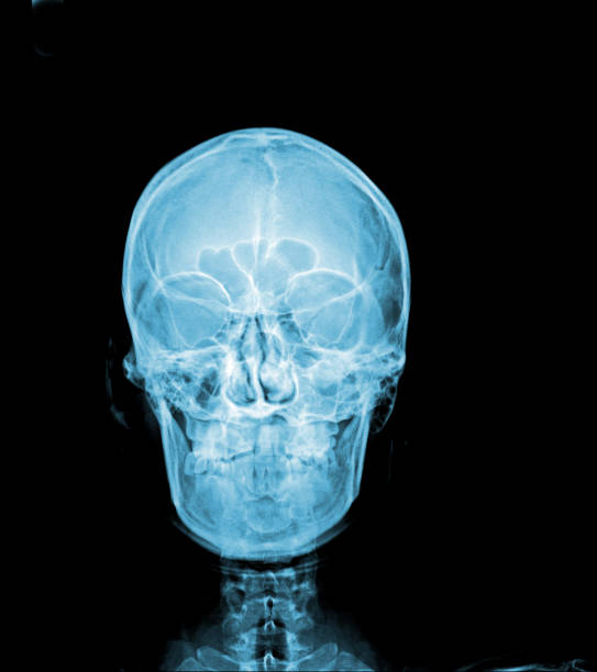 istock X-ray of normal human skull AP. 1461318518