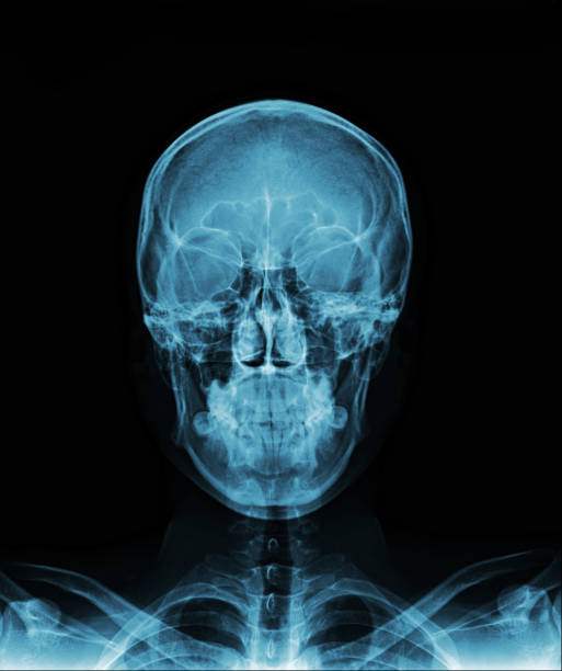istock X-ray of normal human skull AP. 1461318684