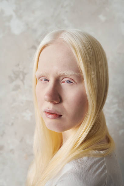 istock Young beautiful albino woman with no makeup looking at camera 1461323032