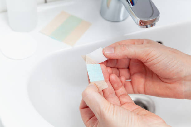 Hands remove the protective layer from the bactericidal patch close-up stock photo