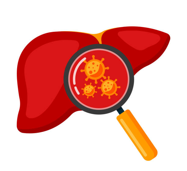 Liver Organ with Magnifying Glass and Virus for Human Anatomy Symbol Vector Illustration Magnifying glass showing bacteria or virus cells in the human liver. Flat icon illustration isolated on white background. Healthy internal organ, anatomy hepatitis stock illustrations