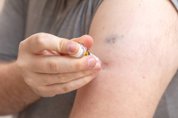 istock Obese young man applying anticoaculant injection 1461899771