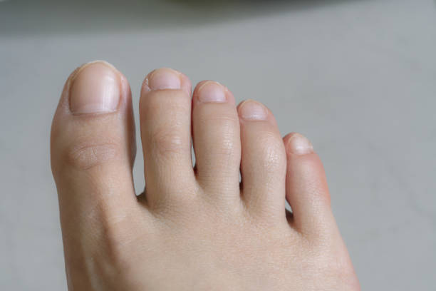 closeup of female toes - on his toes imagens e fotografias de stock