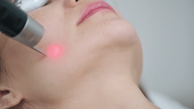 Asian Chinese male Aesthetician laser IPL treatment on his female patient in clinic
