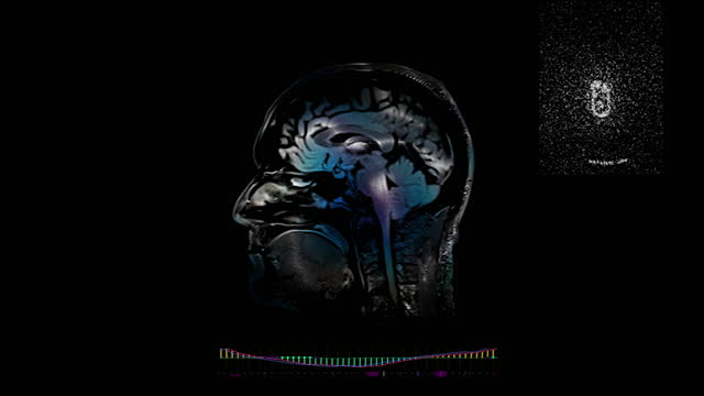 Brain MRI scans and diagnostic hi-tech data screen