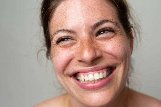 istock A beautiful freckled woman 1462686632