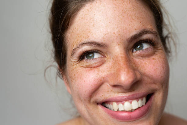 istock A beautiful freckled woman 1462686805