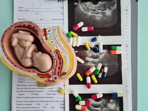 Fetus on the ultrasound and few pills. Ultrasound results in the 2nd trimester of pregnancy Fetus on the ultrasound and few pills. Ultrasound results in the 2nd trimester of pregnancy. infertility treatment. Artificial insemination and the birth of a child with the help of IVF 2nd trimester in pregnancy stock pictures, royalty-free photos & images
