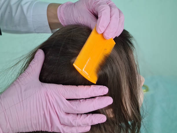 Doctor uses lice comb for little girl hair Doctor uses lice comb for little girl hair. Treatment for lice and dandruff human hair women brushing beauty stock pictures, royalty-free photos & images