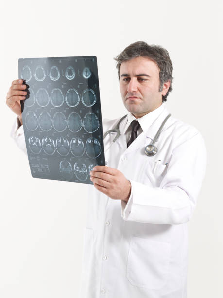 istock Doctor looks at brain scan images 1462781829