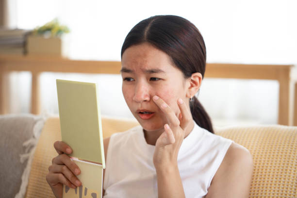 istock Conceptual shot of Acne & Problem Skin on female face. 1462797590