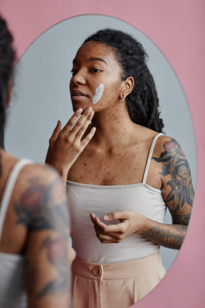 istock Candid young black woman with acne scars using face cream by mirror 1463321968