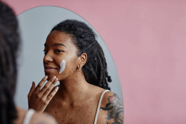 Young black woman with acne scars using face cream looking in mirror Candid portrait of young black woman with acne scars using face cream looking in mirror reflection, copy space scar stock pictures, royalty-free photos & images