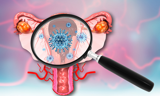 Virus, bacteria infected uterus with magnifying glass. 3d illustration