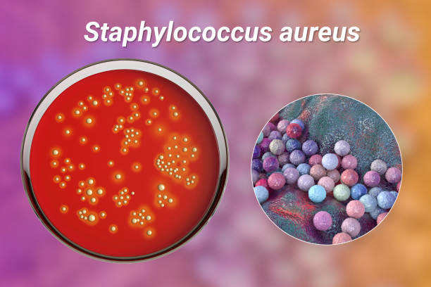 bactéria staphylococcus aureus, ilustração 3d - bacterium staphylococcus colony epidemic - fotografias e filmes do acervo