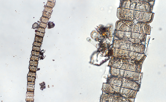 Freshwater aquatic zooplankton and algae under microscope view