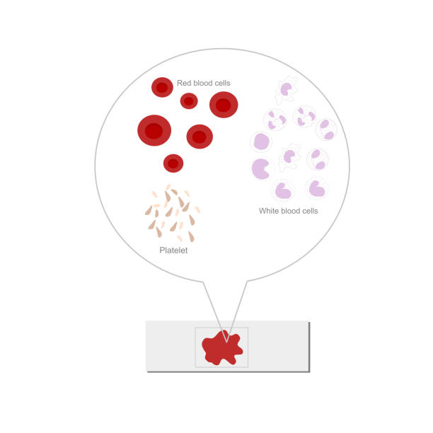 ilustrações de stock, clip art, desenhos animados e ícones de the difference type of blood cell : erythrocyte, lymphocyte and platelet that representation in model of sample slide under investigate. - blood red blood cell blood cell blood sample