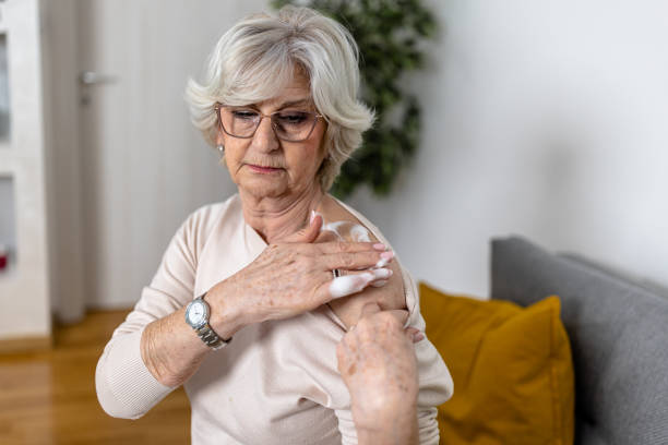 istock A senior grey-haired woman is applying an adhesive patch and cream during menopause symptoms. 1463851415