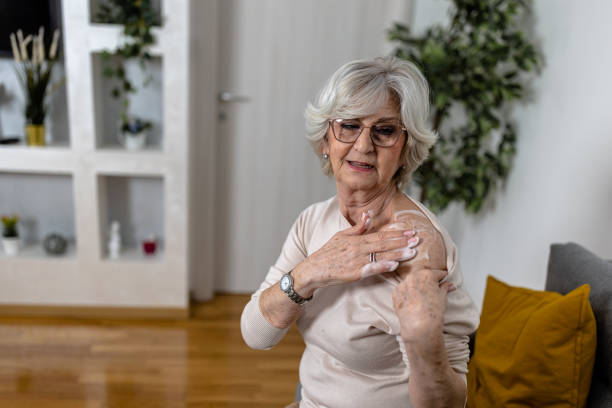 istock Replacement therapy for hormones using a spray with medicine cream. 1463851527