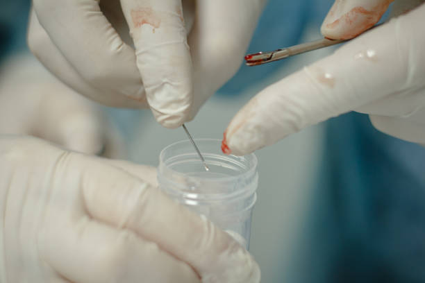 istock The surgeon puts the biopsy material into a container with a farmalin solution. The doctor took a tissue sample at an endoscopy for laboratory analysis. 1463873688