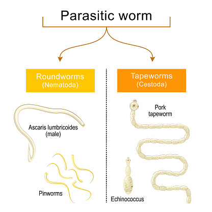 worm infection. Helminthiasis. Common types of parasitic worms or helminths: tapeworms, and roundworms that infected of human gastrointestinal tract. Pinworms and Ascaris lumbricoides, Pork tapeworm and Echinococcus. vector poster