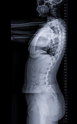 Radiologist doctor examining spinal column by radiography, x-ray and magnetic resonance imaging scan in hospital. Medical check-up and diagnosis. Health insurance concept.
