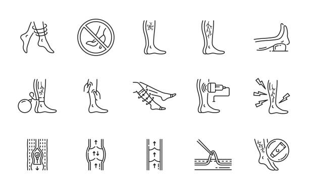 Varicose treatment icons, leg veins thrombosis Varicose treatment icons, leg veins thrombosis disease and surgery vector symbols. Varicose or legs vascular varices circulation insufficiency, medical treatment and prophylactic therapy line icons vein stock illustrations