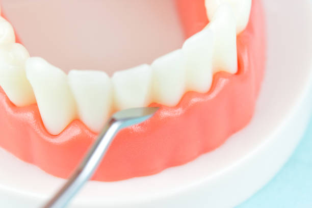 istock False teeth. Artificial jaw on blue background, close-up. Dentoform, Dental teeth model. Dental care and dentist 's equipment concept. Copy space. Tooth model using for a presentation. 1464229404
